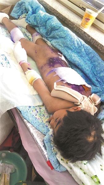 女童遭“國(guó)學(xué)老師”虐打致多處骨折 被罰吃廁紙 女童遭“國(guó)學(xué)老師”虐打致多處骨折 被罰吃廁紙