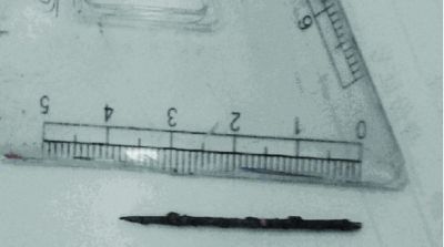 取出的繡花針已發(fā)黑生銹。