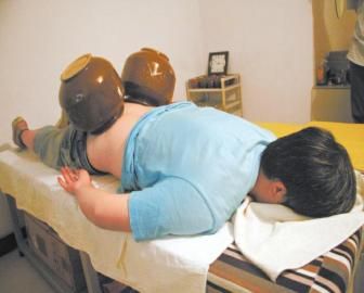 拔泡菜壇子火罐。