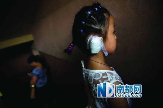 笑笑受傷縫針的耳朵用紗布包扎著 笑笑受傷縫針的耳朵用紗布包扎著