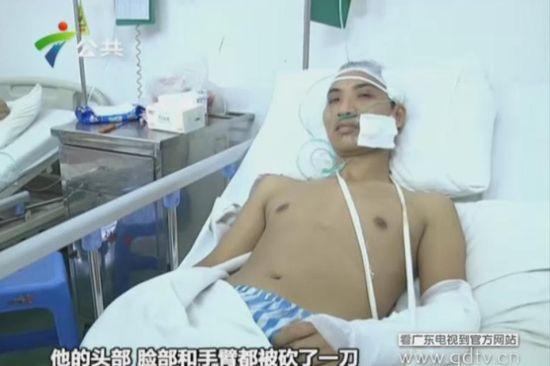 另一名傷者頭部、臉部和手臂都被砍了一刀。(視頻截圖)