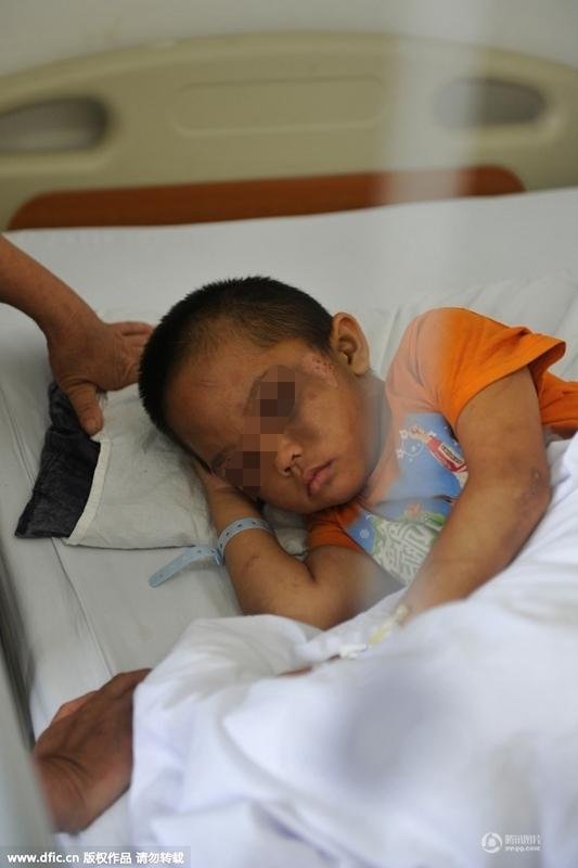 圖為全身傷痕累累的小進(jìn)。