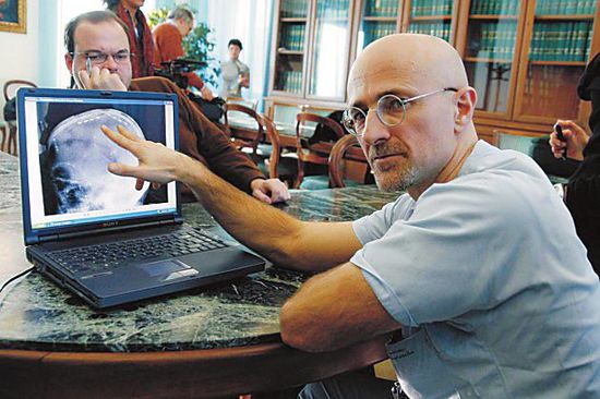 圖為卡納維洛醫(yī)生，不少人認為他的想法非常瘋狂