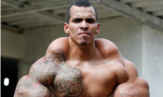 男子癡迷肌肉 注射燃料使肌肉膨脹變 男子癡迷肌肉 注射燃料使肌肉膨脹變