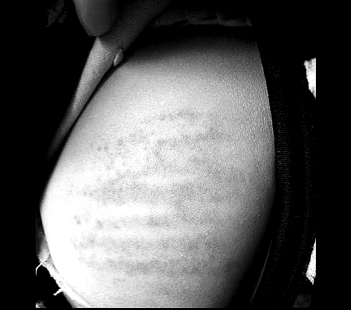 沒帶作業(yè)本 信陽(yáng)潢川4歲娃兒遭老師輪番鞭打 沒帶作業(yè)本 信陽(yáng)潢川4歲娃兒遭老師輪番鞭打