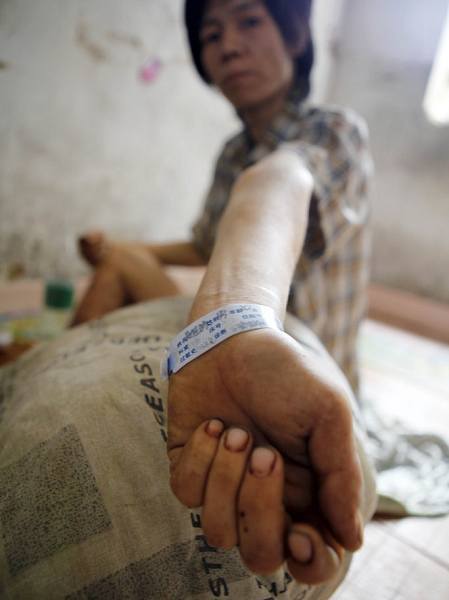 真實(shí)記錄一個吸毒者生命最后19天 真實(shí)記錄一個吸毒者生命最后19天