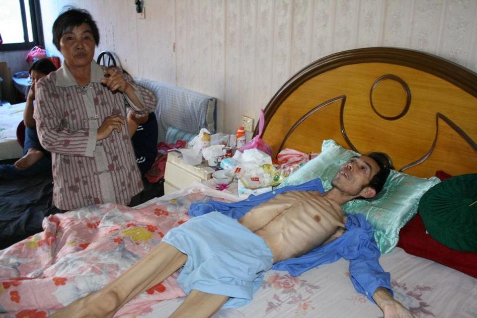 多地水污染嚴(yán)重 “癌癥村”人處境堪憂 多地水污染嚴(yán)重 “癌癥村”人處境堪憂