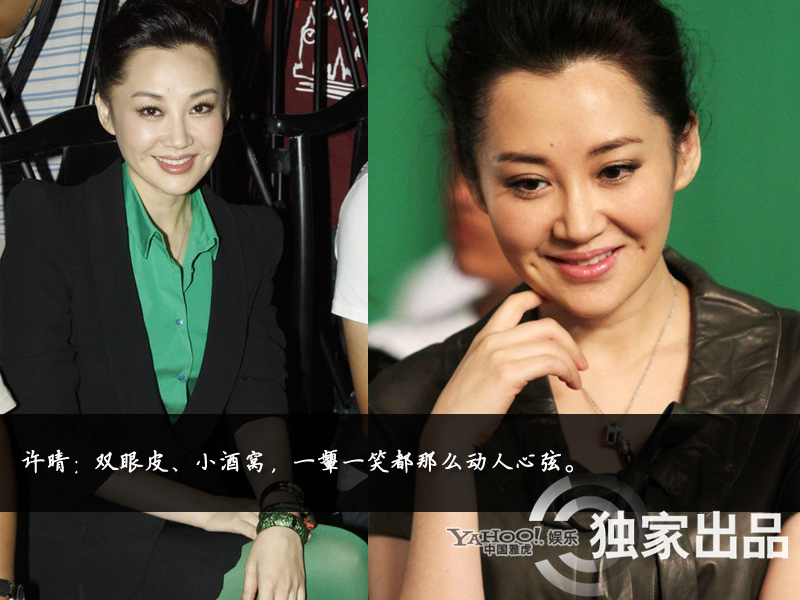 娛樂圈整容成風(fēng):揭露未動刀的天然美女 娛樂圈整容成風(fēng):揭露未動刀的天然美女