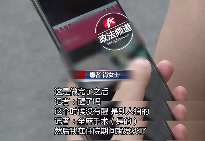 女子花近十萬做豐胸手術 術后胸部潰爛似被啃 女子花近十萬做豐胸手術 術后胸部潰爛似被啃