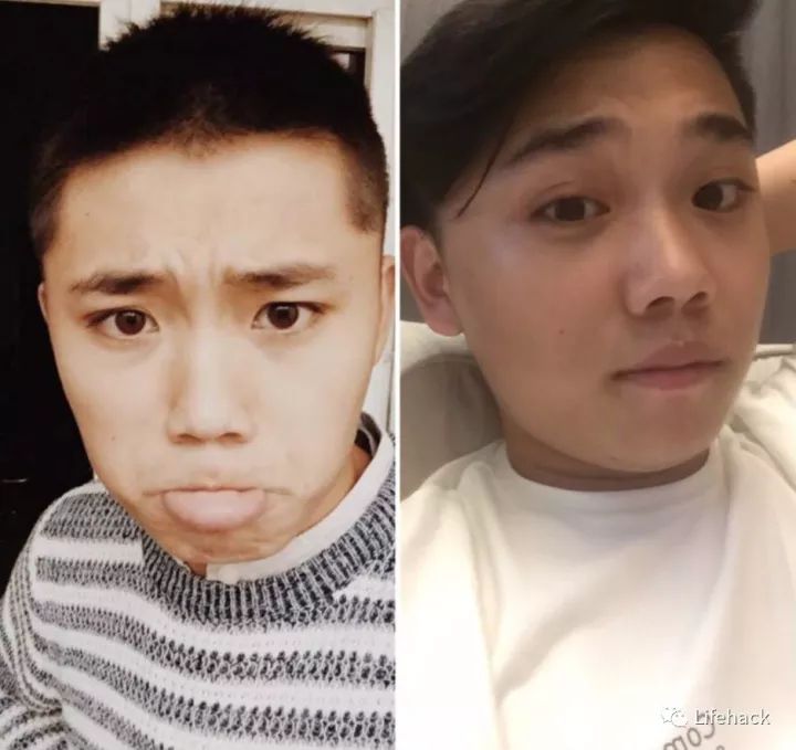 長胖20斤，臉型怎么變？這些例子看完扎心了！