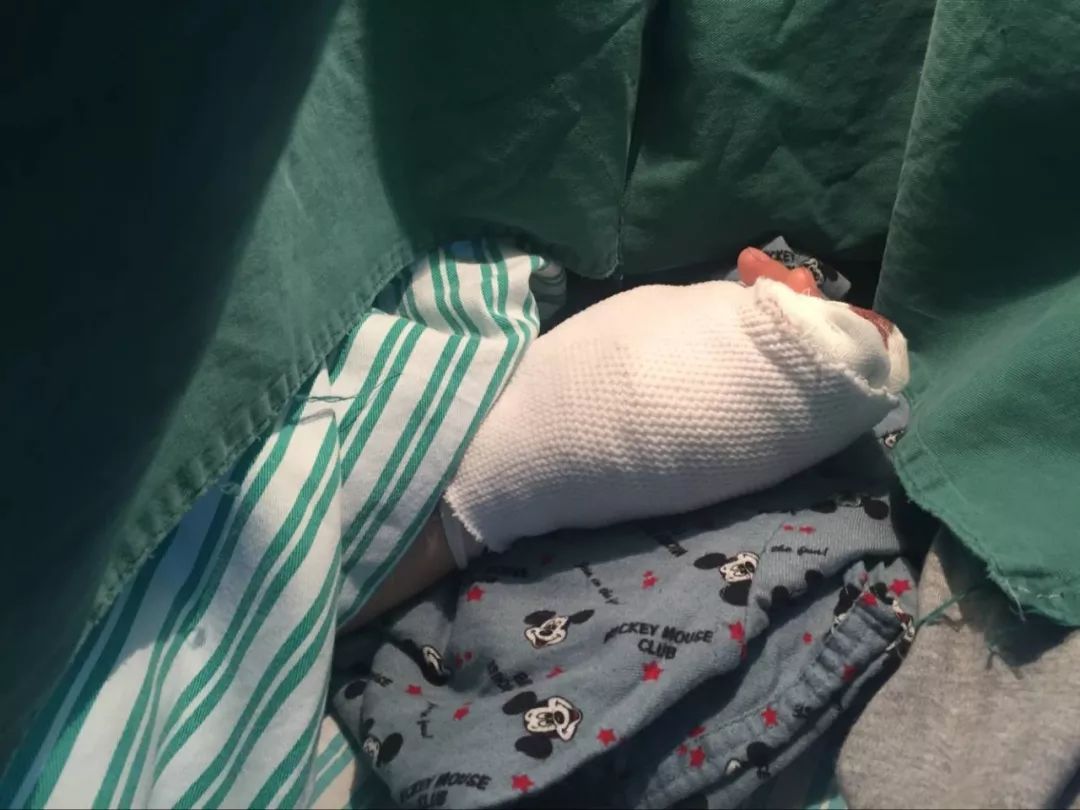 嚇哭！6歲男孩被夾斷手指 罪魁禍?zhǔn)拙故切７? oldsrc=