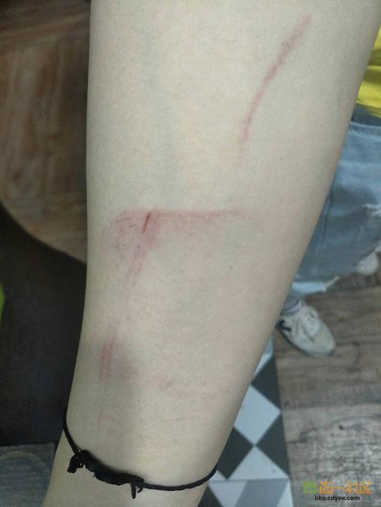 女網(wǎng)友舉報(bào)網(wǎng)帖中出示的被打后照片。