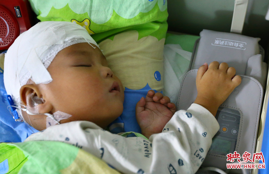 經(jīng)過手術(shù)，小龍病情已經(jīng)逐漸好轉(zhuǎn)，正在甜甜的熟睡