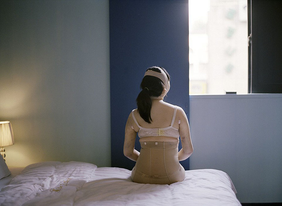 韓攝影師鏡頭記錄患者整容術后的生活 韓攝影師鏡頭記錄患者整容術后的生活