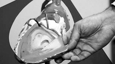 威廉斯領(lǐng)導的研究團隊已經(jīng)利用人體脂肪干細胞，成功3D打印出心臟血管和心臟瓣膜，待一顆心臟的所有部件打