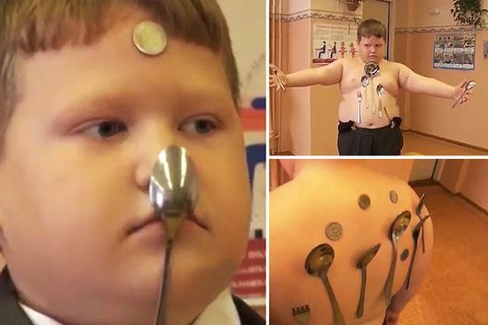 俄男孩被電擊后變“磁鐵人”稱要當(dāng)“英雄” 俄男孩被電擊后變“磁鐵人”稱要當(dāng)“英雄”