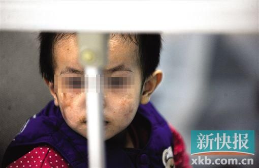 去年3月就能出院的小華(化名),目前還在廣州市婦兒醫(yī)療中心的PICU里住著。新快報(bào)記者 孫毅/攝