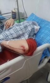 砸窗當(dāng)事人胡女士在醫(yī)院接受治療。