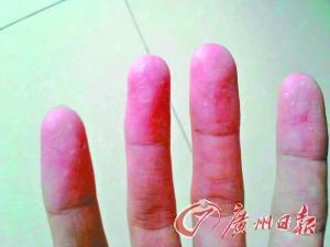 近百學(xué)生沒疊好被子遭體罰 校長(zhǎng)：沒懲罰不叫教育