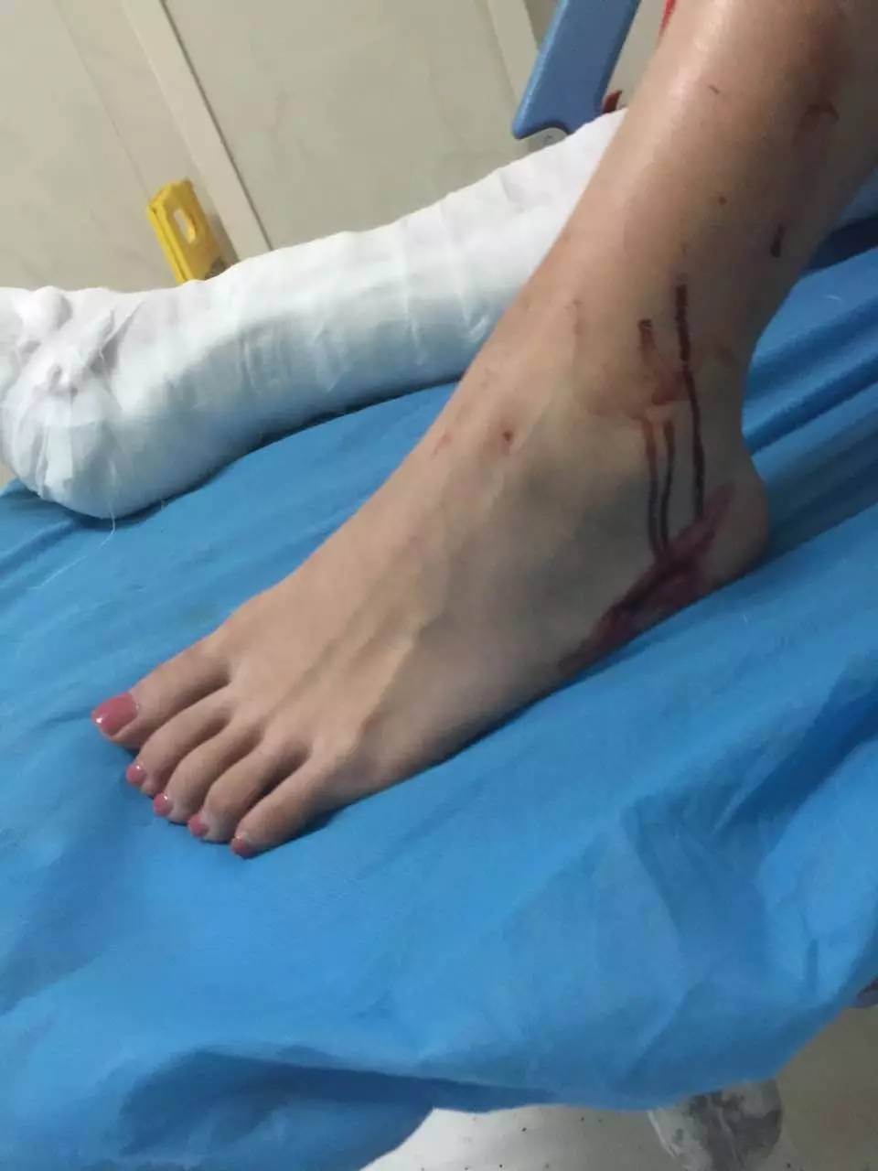 單親媽媽被兩陌生男子打得渾身是血 6歲兒子被嚇哭 單親媽媽被兩陌生男子打得渾身是血 6歲兒子被嚇哭