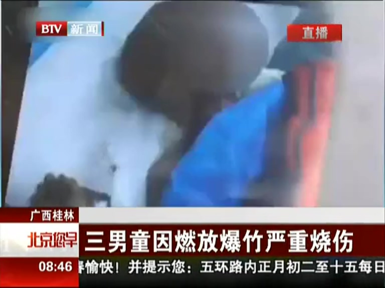 廣西桂林：三男童因燃放爆竹嚴(yán)重?zé)齻? title=