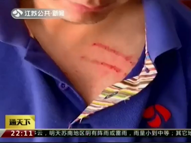 記者報道火災(zāi)卻被毆打