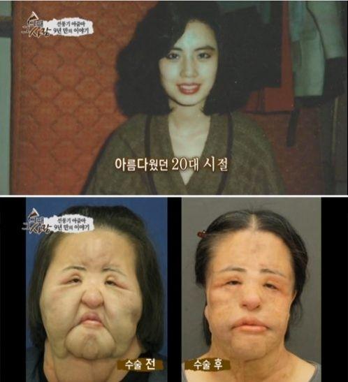 美女整容變“電風扇大媽” 盤點整容失敗驚悚案例 美女整容變“電風扇大媽” 盤點整容失敗驚悚案例