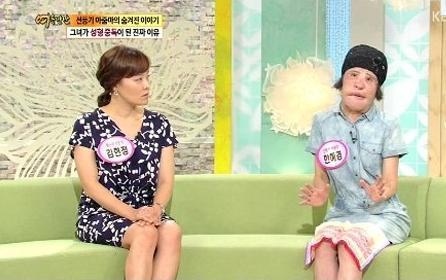 美女整容變“電風扇大媽” 盤點整容失敗驚悚案例 美女整容變“電風扇大媽” 盤點整容失敗驚悚案例